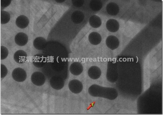 BGA因為焊墊變小，造成錫膏過多而最終形成焊接短路的結(jié)果。
